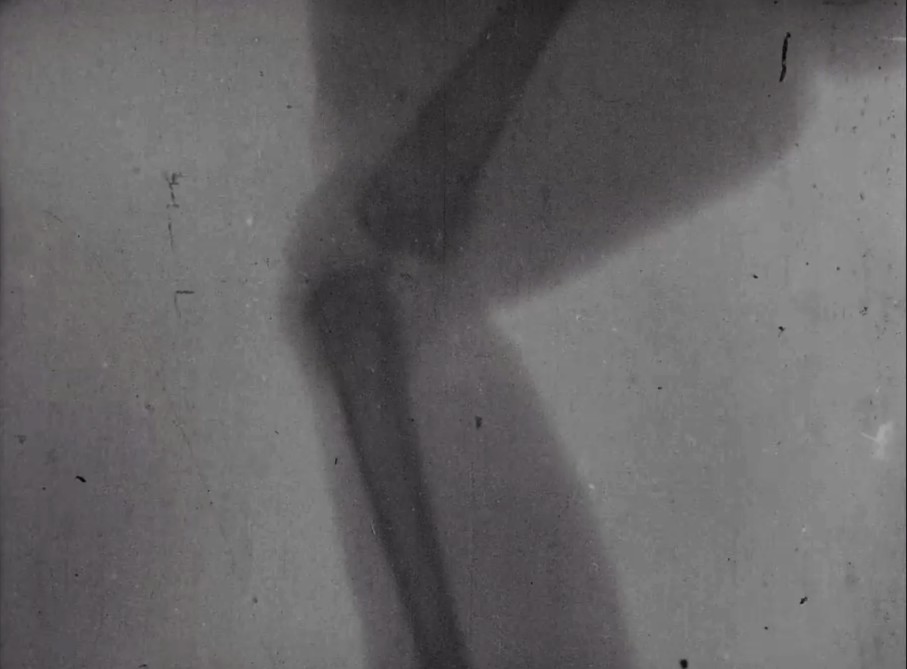 Frogs legs on film: trailblazing Victorian medical research